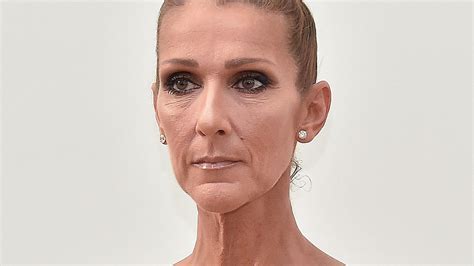 celine dion health